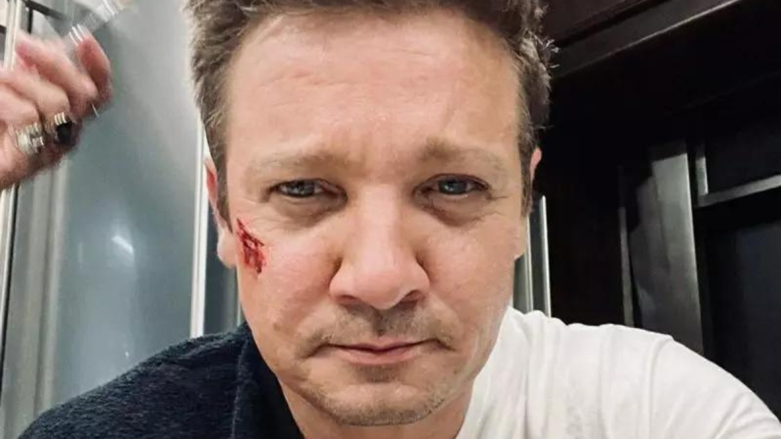 Jeremy Renner é liberado do hospital após grave acidente